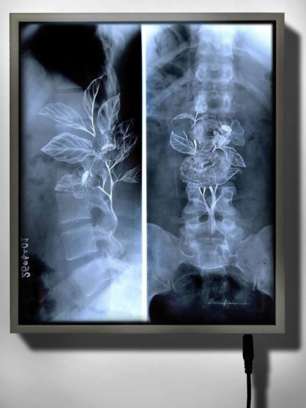 Nunzio Paci - Vertebre di Campo